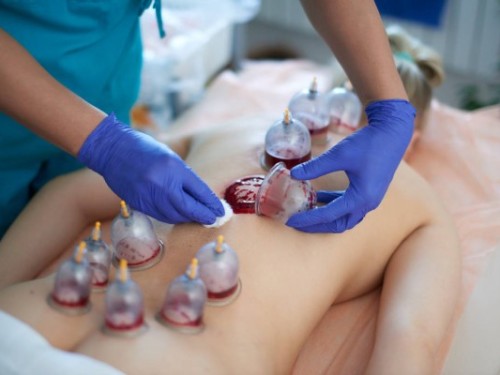 depositphotos_247537060-stock-photo-healing-bloodletting-hijama-phlebotomy-hajam