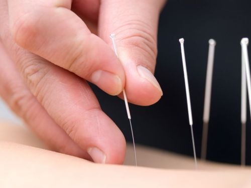 hand-needle